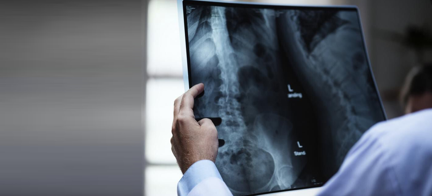 Revolutionizing Healthcare: Integrating Mobile X-Ray Machines at Zubaida Medical Centre